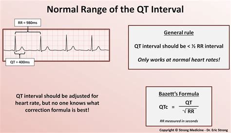 bazzet|Corrected QT Interval (QTc)